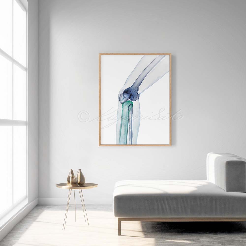 Knee Bones Orthopedics Art Poster