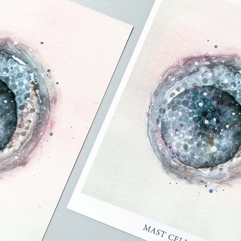 Mast Cell