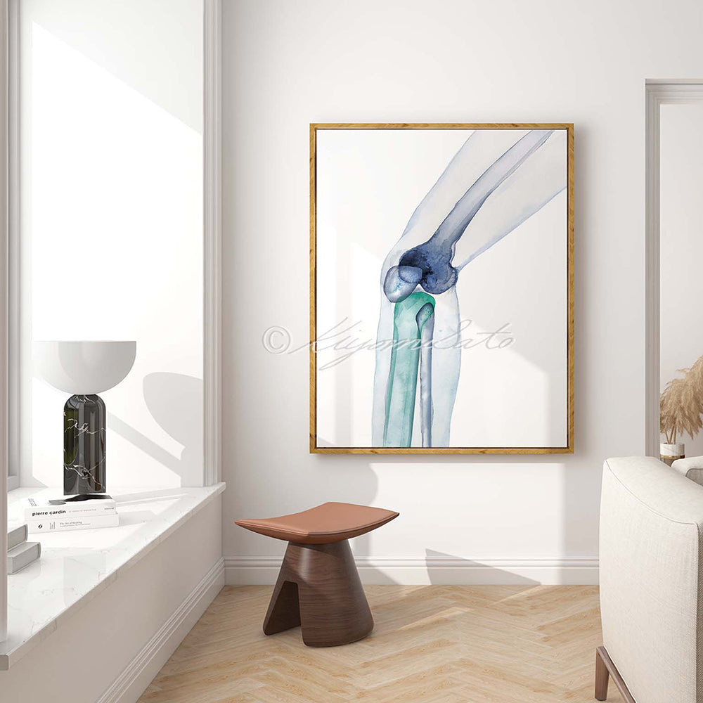 Knee Bones Orthopedics Art Poster
