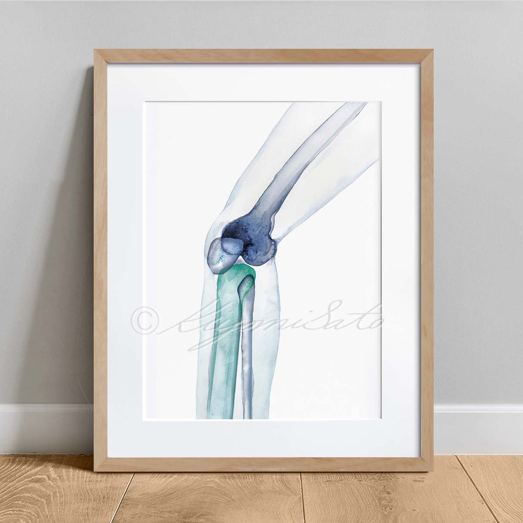 Knee Bones Orthopedics Art Poster