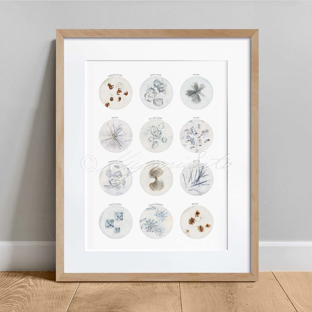 Crystals in Human Urine Collection, Science Art Poster