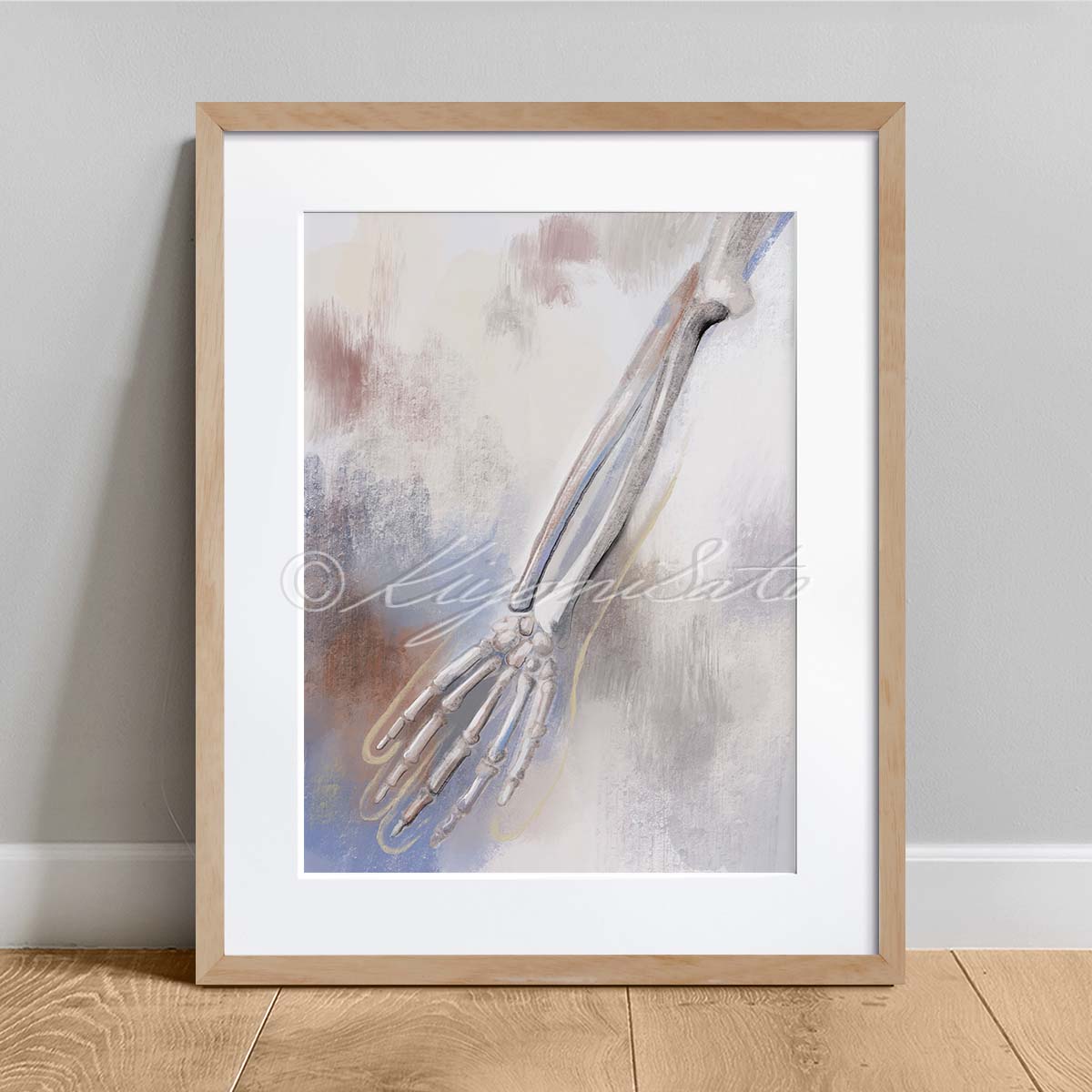Arm Bones Abstract Rust Color Orthopedics Art Poster – The Forest Cloak