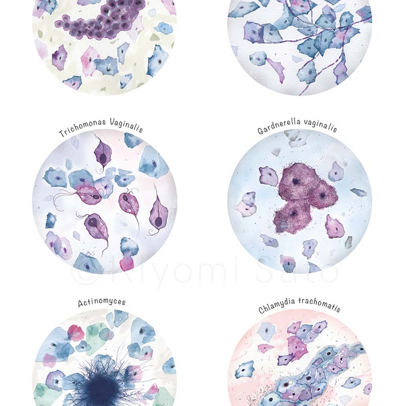 Pap Smear Common Pathogens Collection