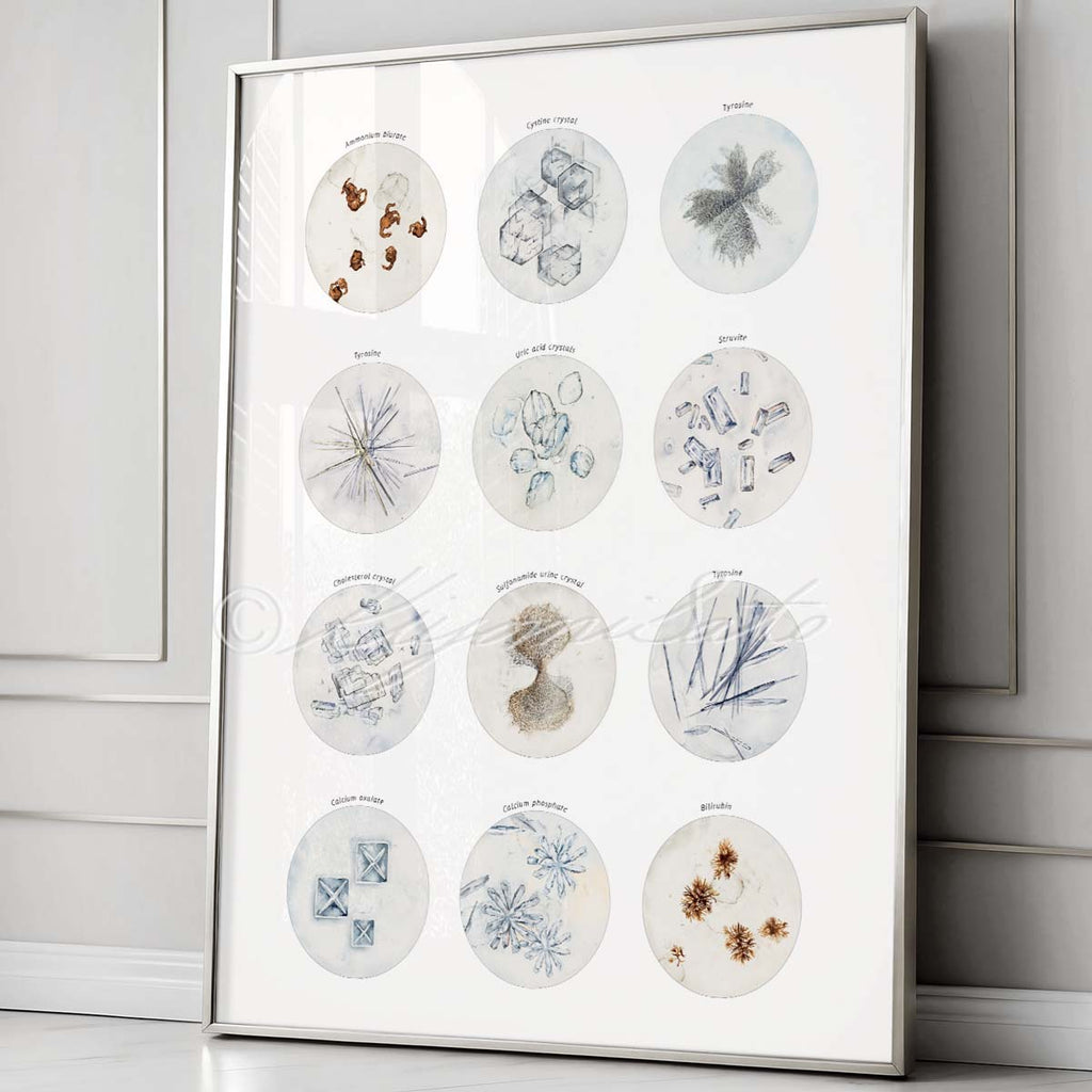 Crystals in Human Urine Collection, Science Art Poster