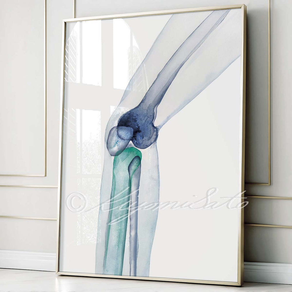 Knee Bones Orthopedics Art Poster