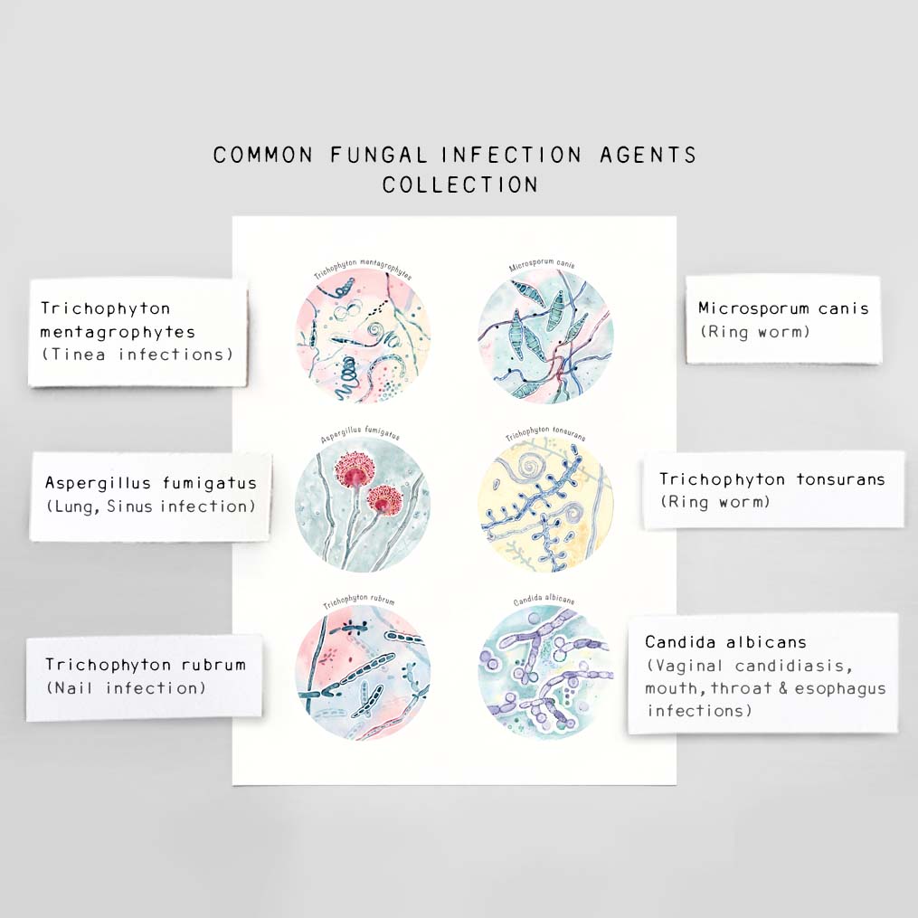 Common Fungal Infection Agents Collection