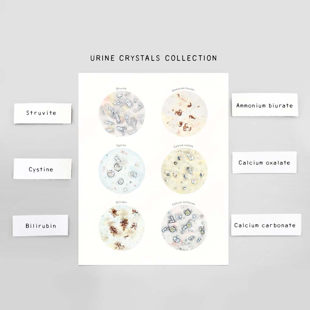 Crystals in Urine Collection Veterinary Art