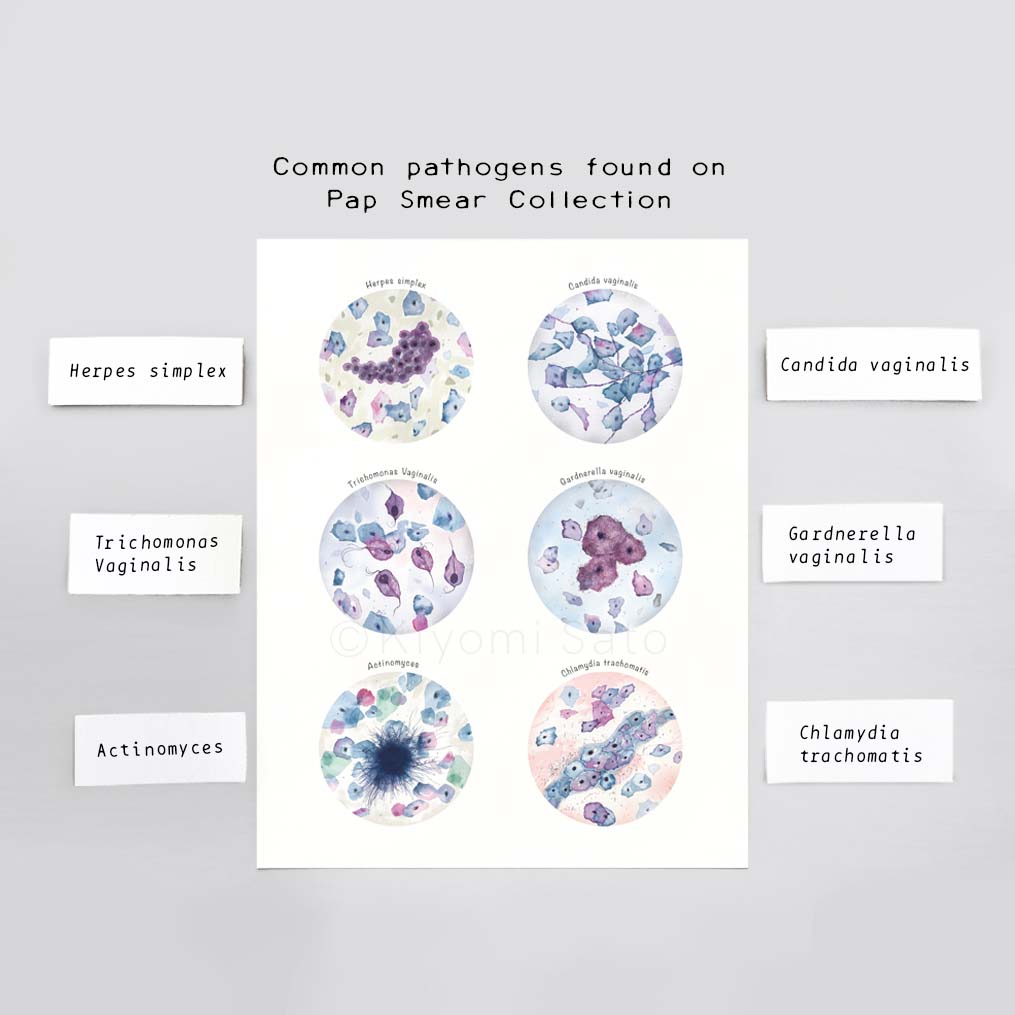 Pap Smear Common Pathogens Collection