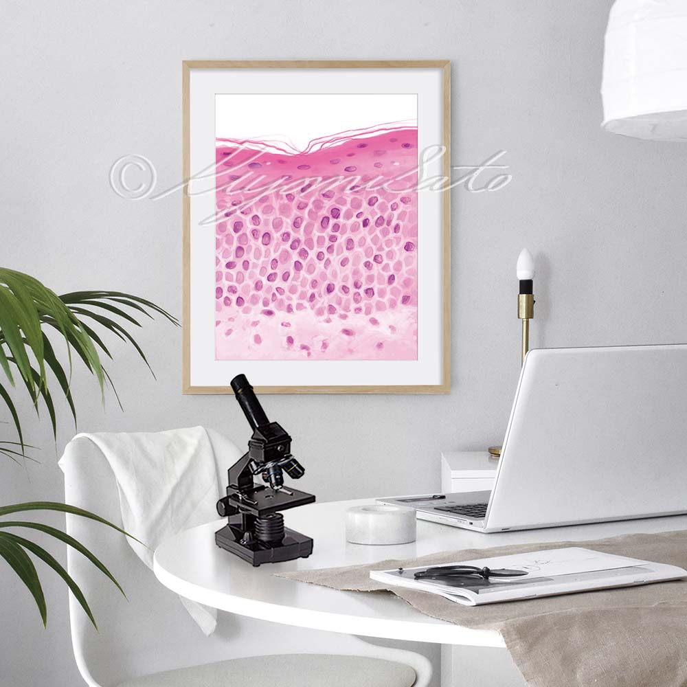 Parakeratosis pathology art print