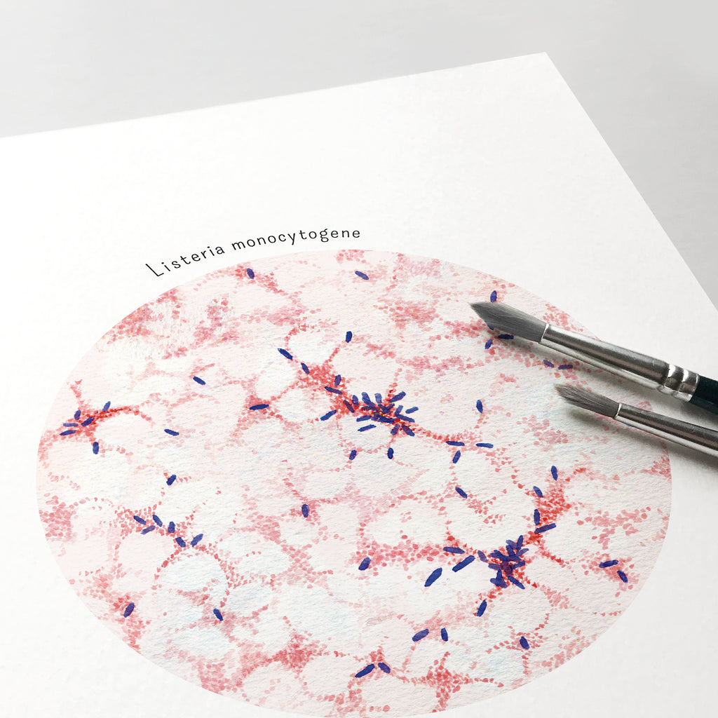 Listeria monocytogenes