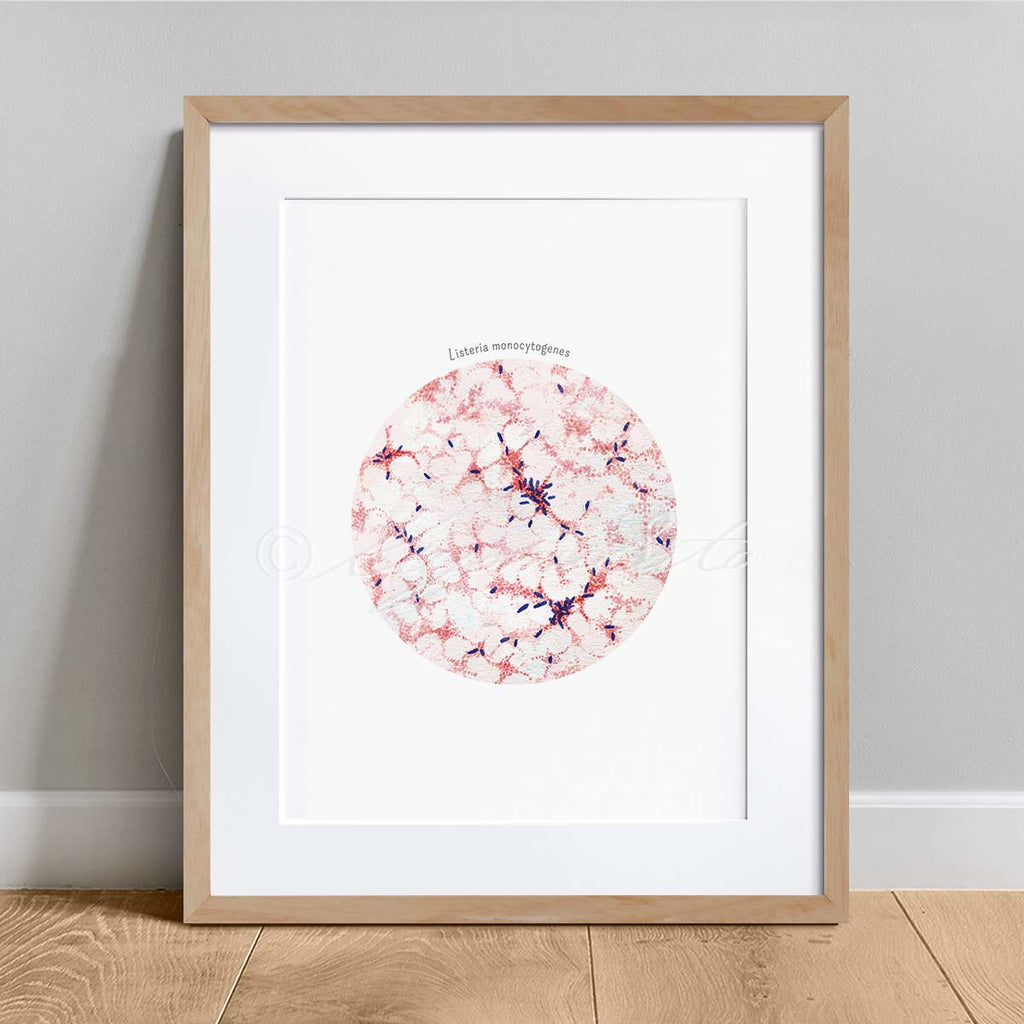 Listeria monocytogenes