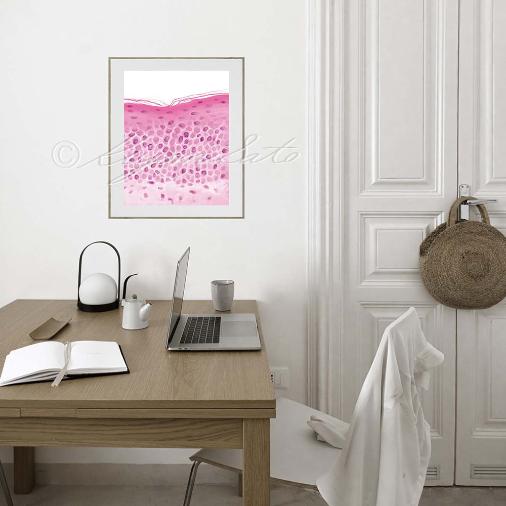 Parakeratosis pathology art print