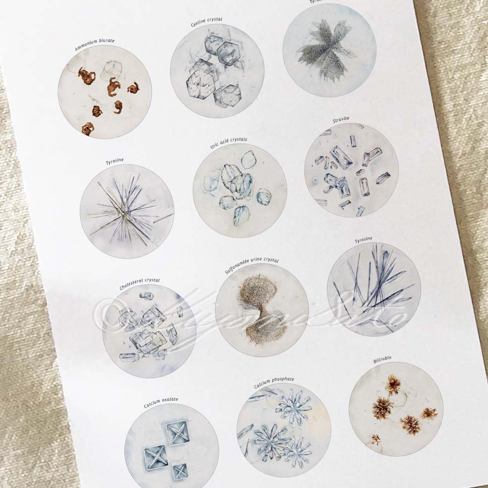 Crystals in Human Urine Collection, Science Art Poster
