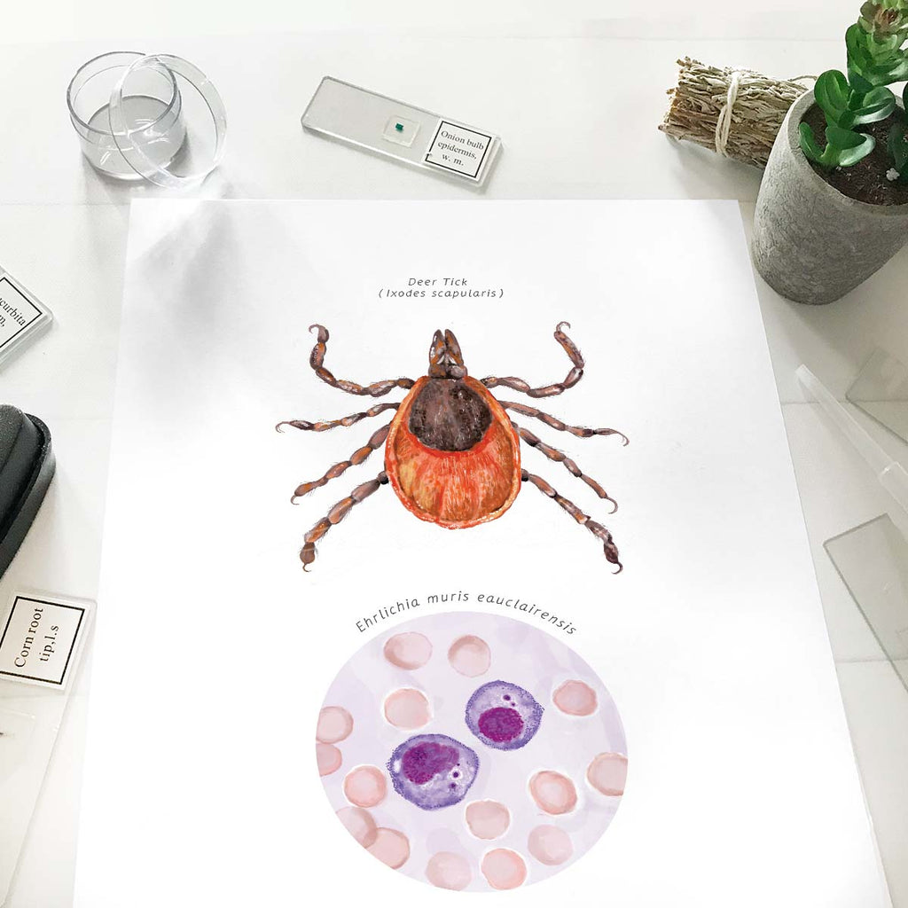 Deer Tick Vector Ehrlichiosis Poster