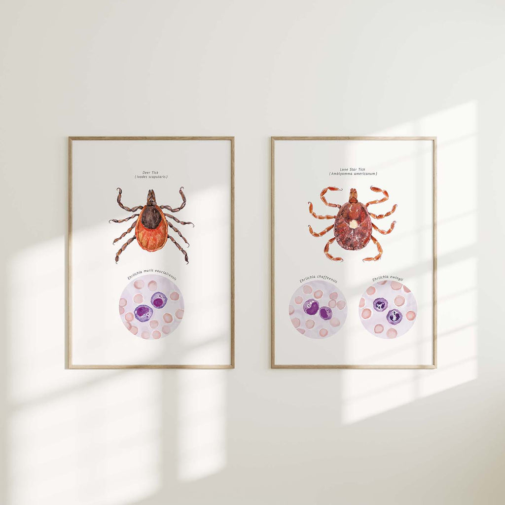 Lone Star Tick and Deer Tick Vector Ehrlichiosis Set of 2 Posters