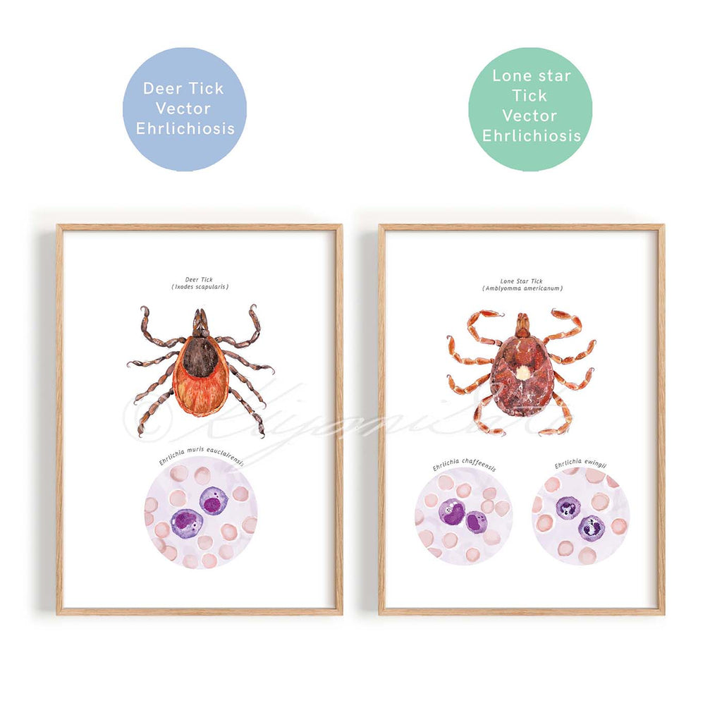 Lone Star Tick and Deer Tick Vector Ehrlichiosis Set of 2 Posters