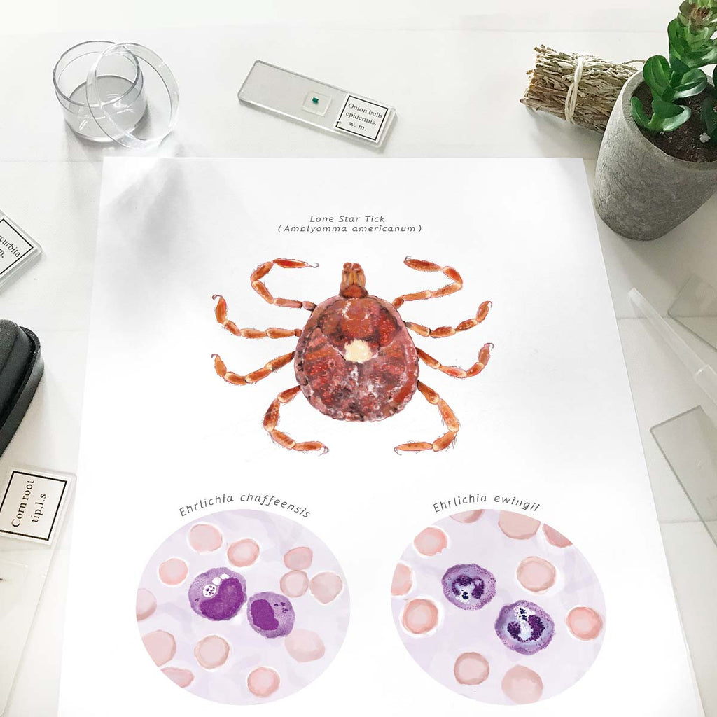 Lone Star Tick Vector Ehrlichiosis Poster