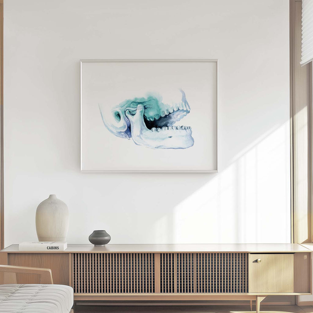 Open Jaw TMJ Art Print